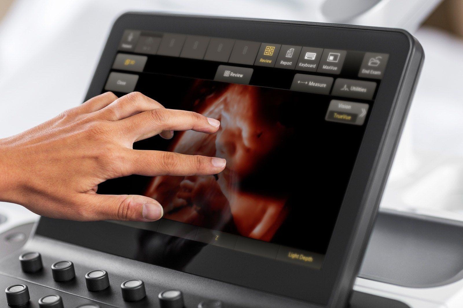 Screen based. Innosight Philips УЗИ. Philips Ultrasound. Искусственный интеллект в УЗИ. 3d-визуализация TRUEVUE УЗИ.